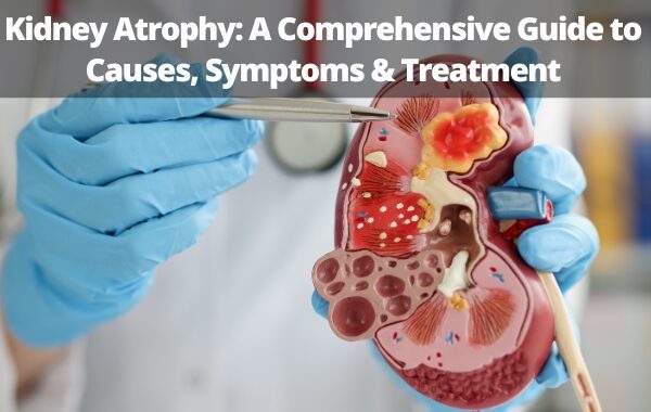 Kidney Atrophy: A Comprehensive Guide to Causes, Symptoms & Treatment