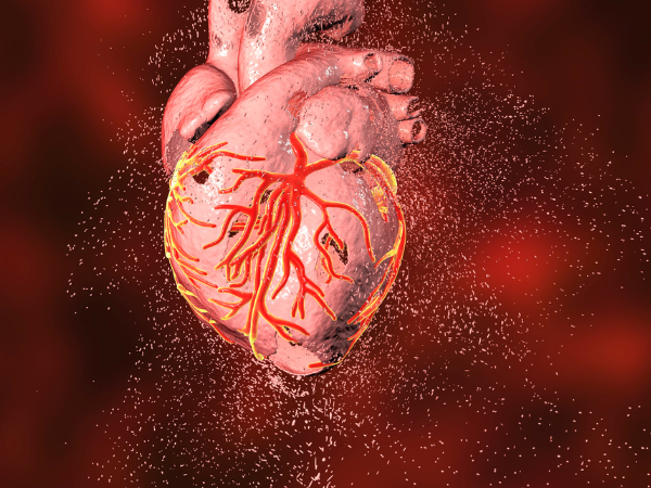 Myocardial Infarction Market Size and Share Report 2024-2032