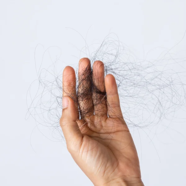 Hair Loss Myths vs. Facts: Separating Truth from Fiction