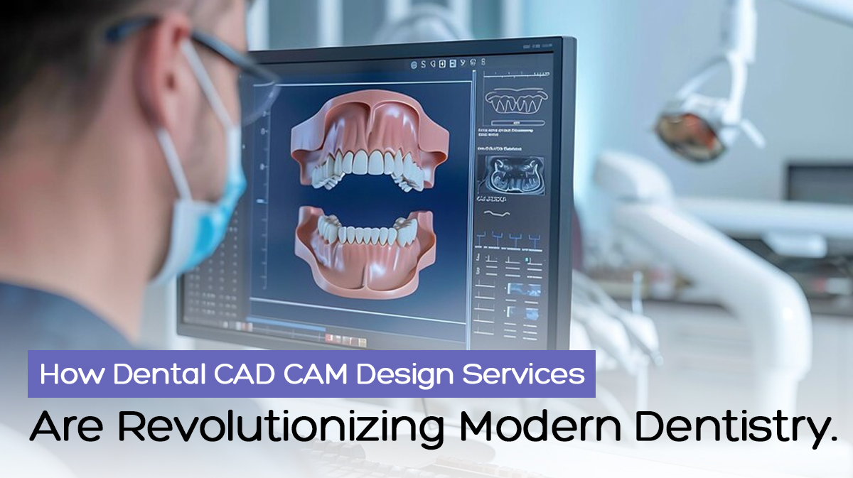 How Dental CAD CAM Design Services Are Revolutionizing Modern Dentistry