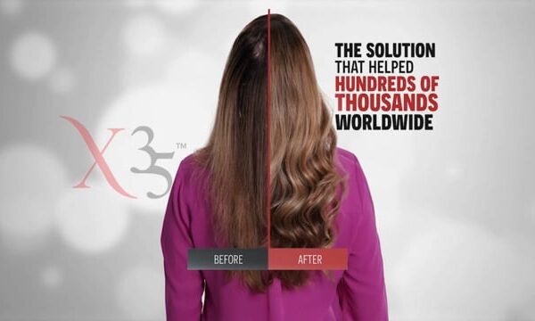 HAIR XCELLERATION PROGRAM