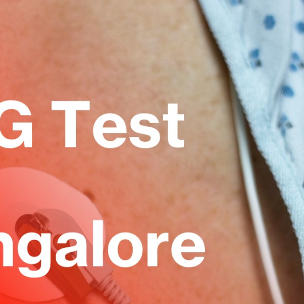 ecg test near bangalore