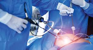 United States Endoscopy Devices Market Analysis And Growth Forecast 2024-2030